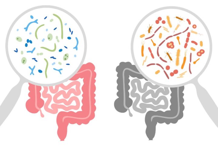 Probiotics for Immune Function Support
